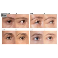 L'Oreal Lu0027Oréal Clinically Proven Wimperserum -Cosmetica Serie Winkel 994623 4